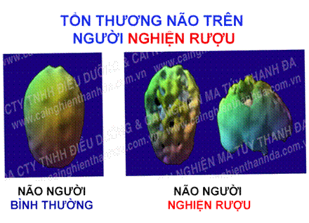 http://cainghienthanhda.com.vn/images/new/image002.png
