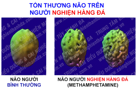 http://cainghienthanhda.com.vn/images/new/image004.png